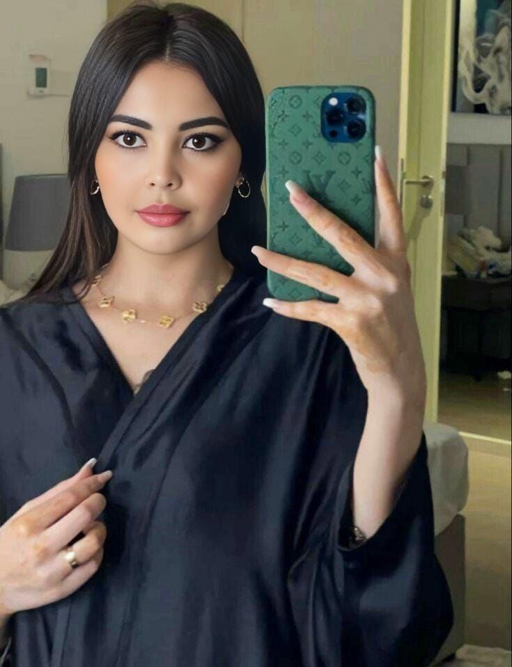 ZEYNEP — Kuşadası Escort